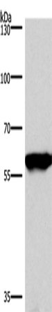 PPP3CA Polyclonal Antibody (E-AB-14813)