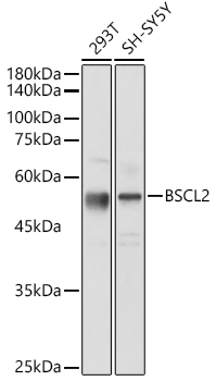 BSCL2 Polyclonal Antibody (E-AB-90891)