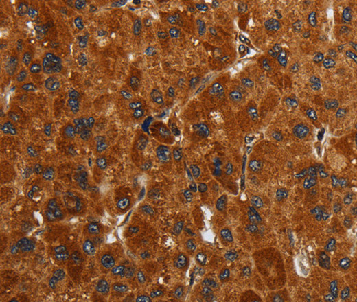 ENTPD7 Polyclonal Antibody (E-AB-15205)