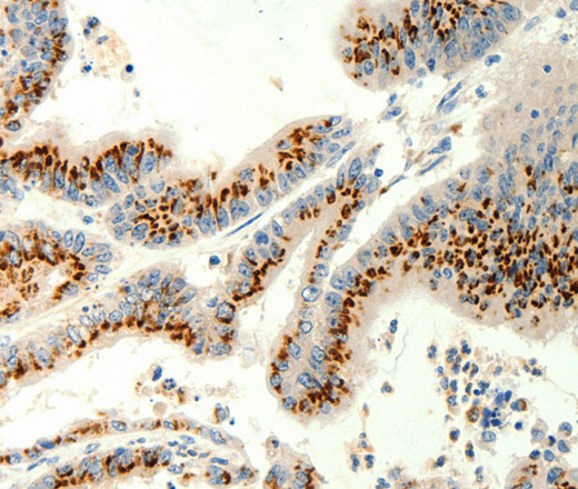 TRPC6 Polyclonal Antibody (E-AB-12914)