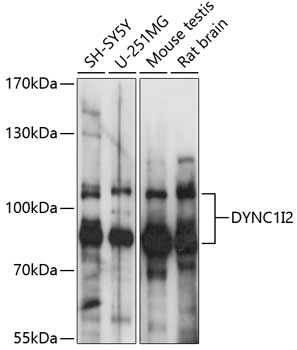 DYNC1I2 Polyclonal Antibody (E-AB-90937)