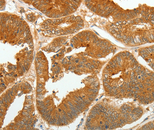 ASCL1 Polyclonal Antibody (E-AB-12280)