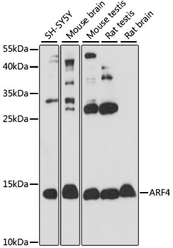 ARF4 Polyclonal Antibody (E-AB-92793)