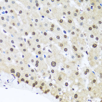FUBP1 Polyclonal Antibody (E-AB-62290)
