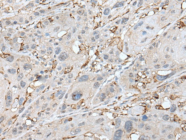 CD14 Polyclonal Antibody (E-AB-52404)
