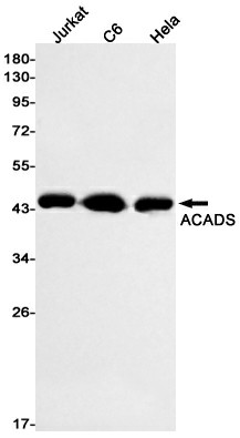 Recombinant ACADS Monoclonal Antibody (E-AB-81522)