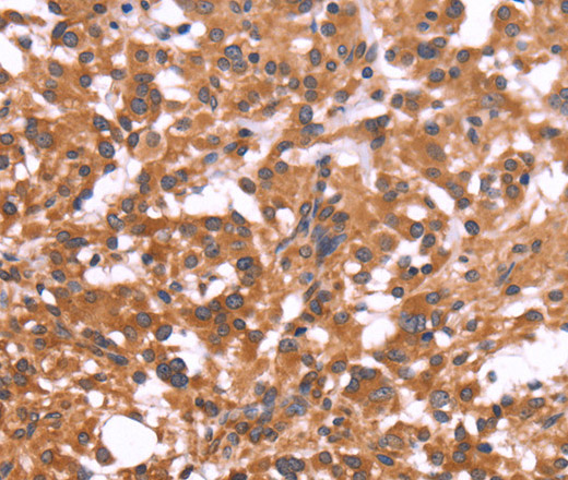 CRISP3 Polyclonal Antibody (E-AB-11104)