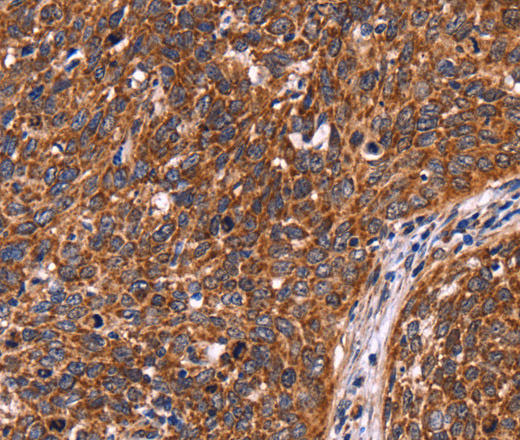 CCDC106 Polyclonal Antibody (E-AB-11038)