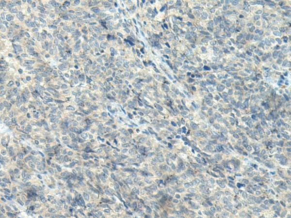 NPVF Polyclonal Antibody (E-AB-17956)