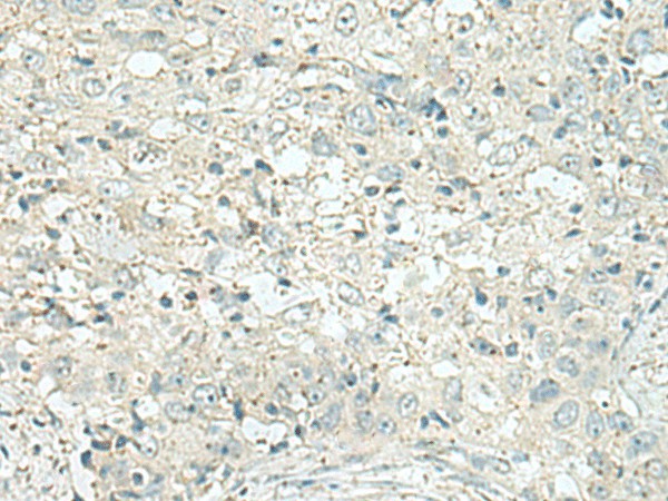 DENND6A Polyclonal Antibody (E-AB-52990)