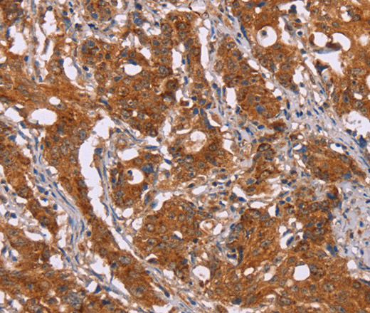 DCTN6 Polyclonal Antibody (E-AB-14940)