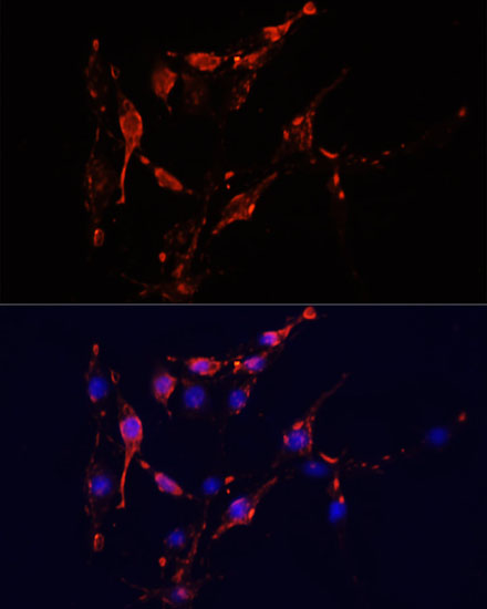 ICAM1 Polyclonal Antibody (E-AB-67682)