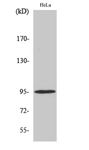 Phospho-Glucocorticoid Receptor (Ser211) Polyclonal Antibody (E-AB-21144)