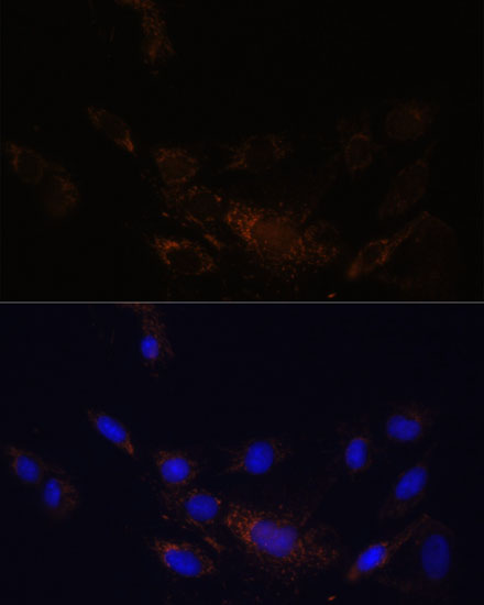 PSMB7 Polyclonal Antibody (E-AB-65104)