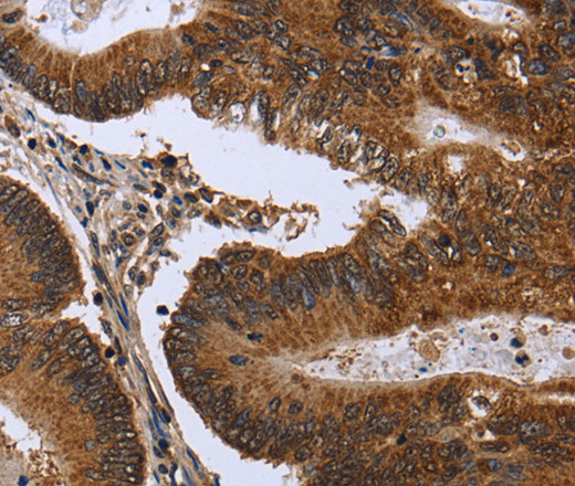 FGFR1OP Polyclonal Antibody (E-AB-11232)