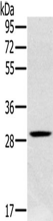 CLIC1 Polyclonal Antibody (E-AB-15231)
