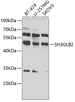 SH3GLB2 Polyclonal Antibody (E-AB-67896)