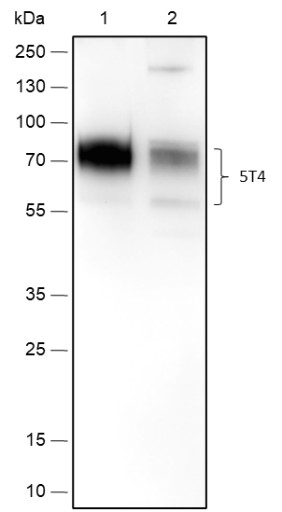 Recombinant 5T4 Monoclonal Antibody (AN301765L)