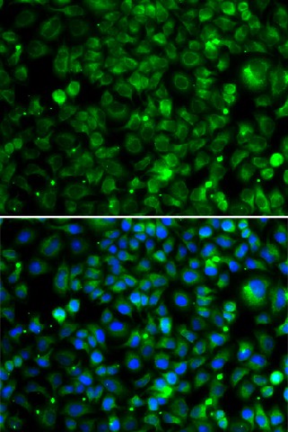 TMLHE Polyclonal Antibody (E-AB-61642)