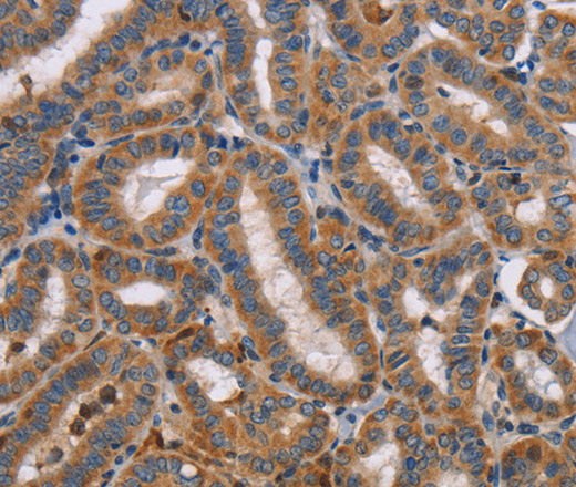 TLR8 Polyclonal Antibody (E-AB-10873)