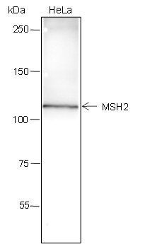 Recombinant MSH2 Monoclonal Antibody (AN301604L)