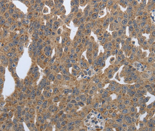 PDIA2 Polyclonal Antibody (E-AB-16032)