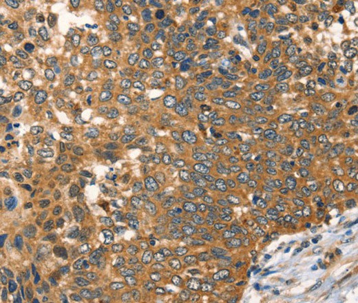 AGO1 Polyclonal Antibody (E-AB-16400)