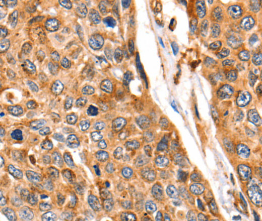 Cathepsin B Polyclonal Antibody (E-AB-10208)