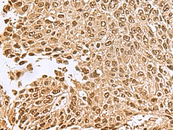 NVL Polyclonal Antibody (E-AB-53002)