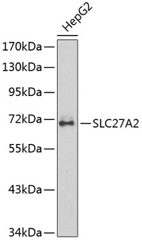 SLC27A2 Polyclonal Antibody (E-AB-60173)
