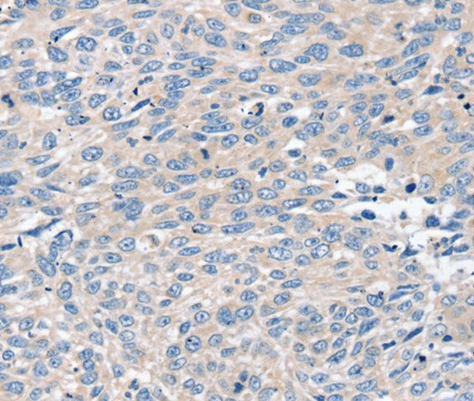 ROR1 Polyclonal Antibody (E-AB-16872)