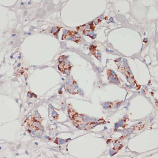 ACSL3 Polyclonal Antibody (E-AB-65831)