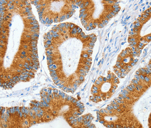 MANF Polyclonal Antibody (E-AB-16174)