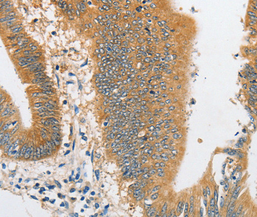ARHGAP5 Polyclonal Antibody (E-AB-14603)
