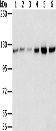 RBM5 Polyclonal Antibody (E-AB-15336)