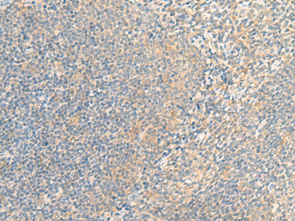 IFNA5 Polyclonal Antibody (E-AB-52012)