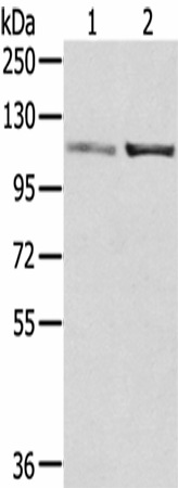 SENP7 Polyclonal Antibody (E-AB-17021)