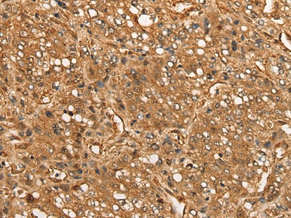 CALML6 Polyclonal Antibody (E-AB-17762)