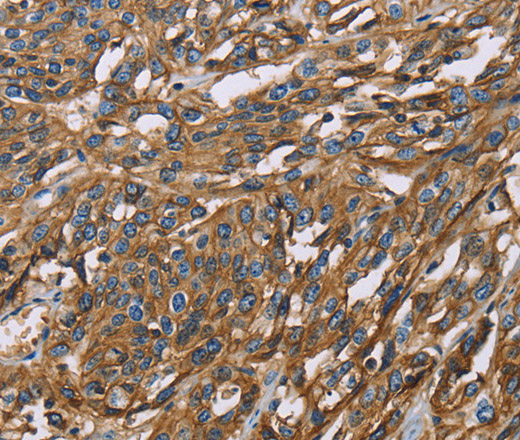 BSG Polyclonal Antibody (E-AB-11042)