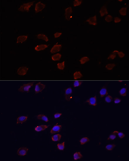 ARF6 Polyclonal Antibody (E-AB-60130)