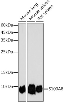 S100A8 Polyclonal Antibody (E-AB-93263)