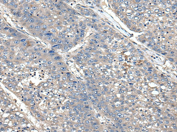 XDH Polyclonal Antibody (E-AB-53551)