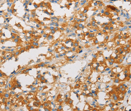 ART3 Polyclonal Antibody (E-AB-14633)