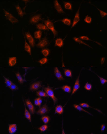 COL4A3BP Polyclonal Antibody (E-AB-65290)