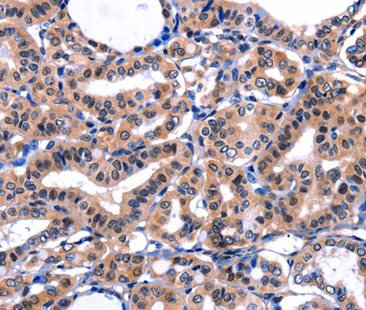FBN1 Polyclonal Antibody (E-AB-15631)
