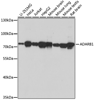 ADARB1 Polyclonal Antibody (E-AB-66927)