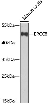 ERCC8 Polyclonal Antibody (E-AB-62045)