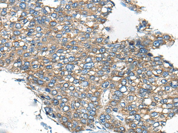 CDC42BPA Polyclonal Antibody (E-AB-17780)