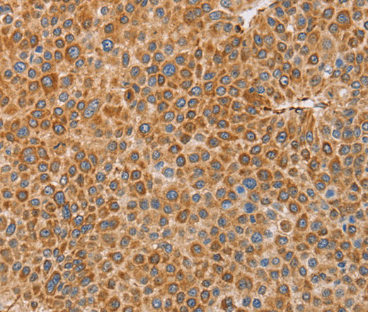 BRS3 Polyclonal Antibody (E-AB-13097)