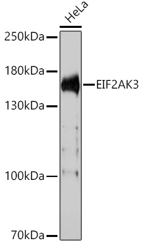 EIF2AK3 Polyclonal Antibody (E-AB-67315)